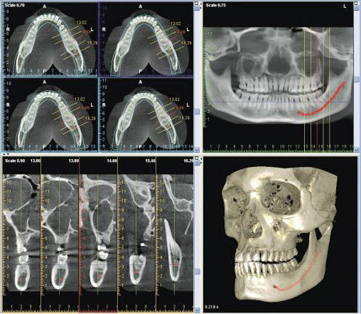 Рентген зуба при кормлении грудью - «Московский Доктор»